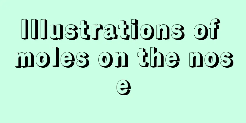 Illustrations of moles on the nose