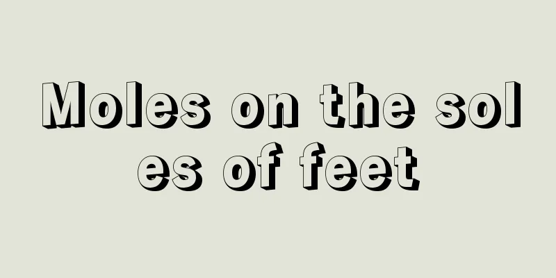 Moles on the soles of feet