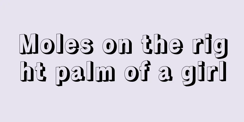 Moles on the right palm of a girl