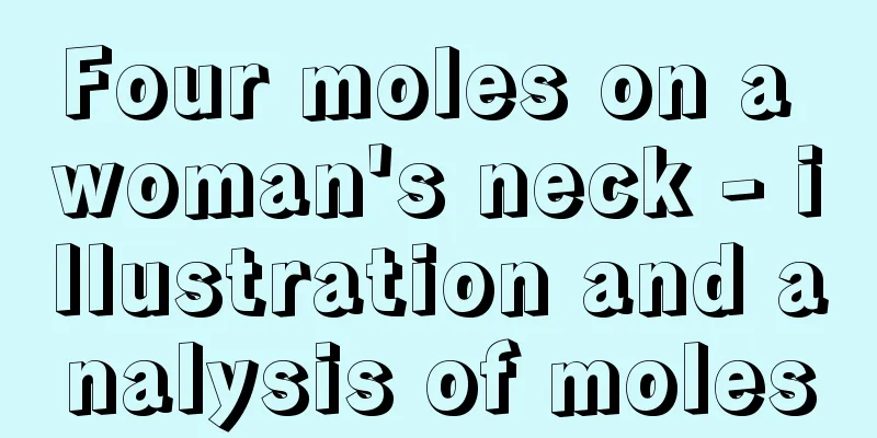 Four moles on a woman's neck - illustration and analysis of moles