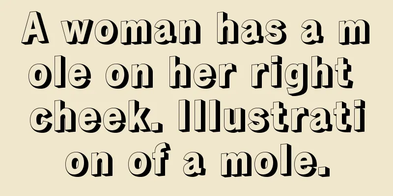 A woman has a mole on her right cheek. Illustration of a mole.