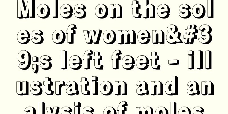 Moles on the soles of women's left feet - illustration and analysis of moles