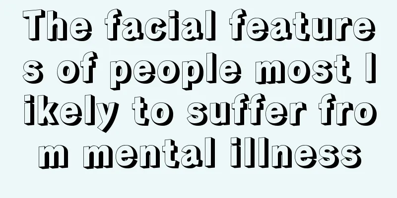 The facial features of people most likely to suffer from mental illness
