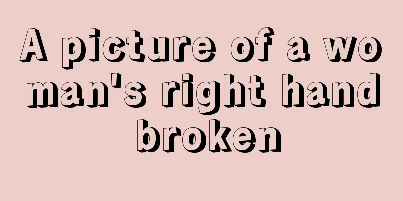 A picture of a woman's right hand broken