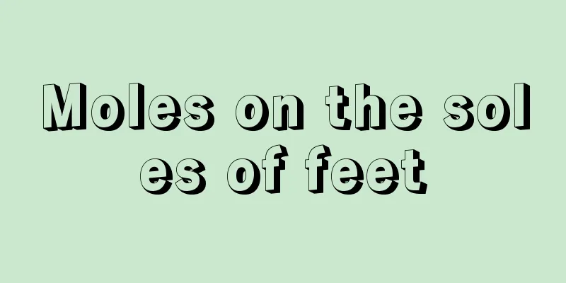 Moles on the soles of feet