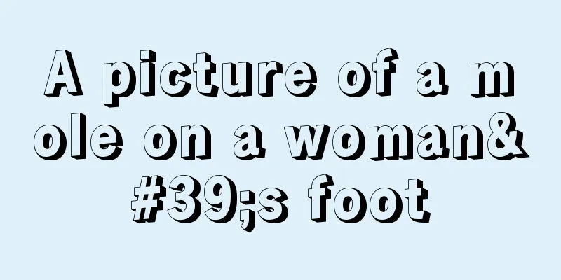 A picture of a mole on a woman's foot