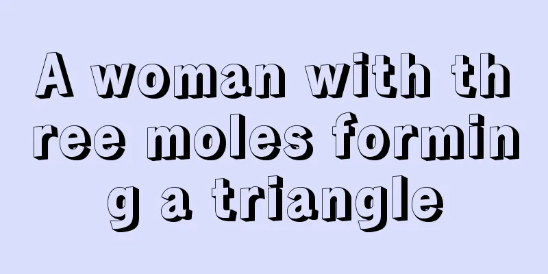 A woman with three moles forming a triangle