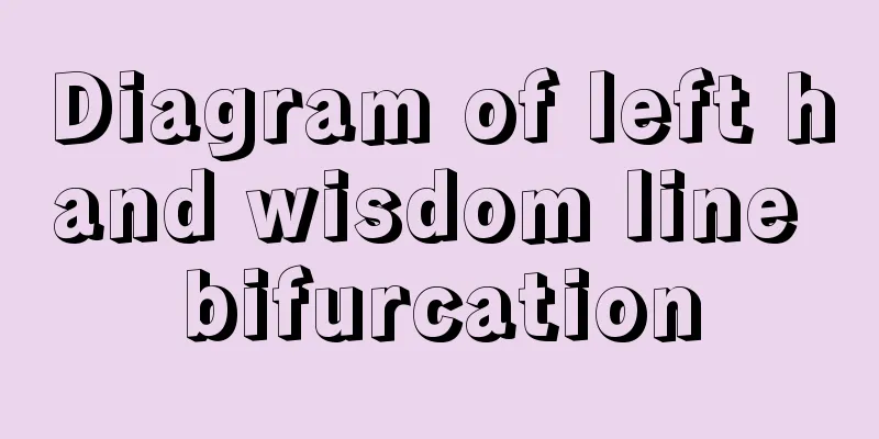 Diagram of left hand wisdom line bifurcation