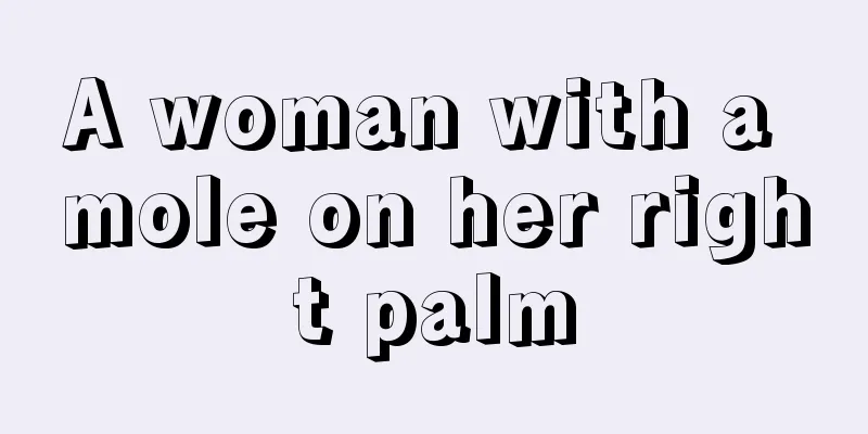 A woman with a mole on her right palm